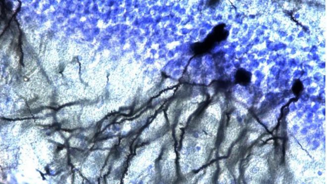 Tinción Golgi-Cox / Nissl de neuronas granulares del giro dentado de hipocampo de ratón. ©: Unidad de Investigación Neurovascular de la UCM.