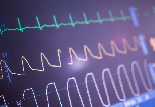 Nueva herramienta de IA identifica riesgo de bloqueo cardíaco en pacientes mediante ECG
