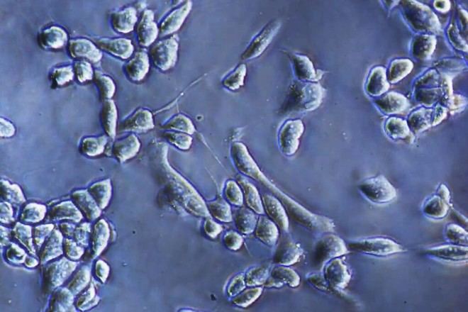 Nueva técnica para separar células de superficies de cultivo sin enzimas