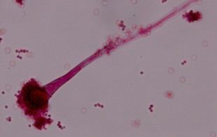 Estudian la resistencia del hongo Aspergillus fumigatus en el aire de Madrid