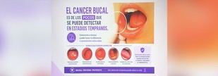 Prevención y detección temprana son clave contra el cáncer bucal