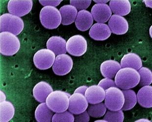 Investigadores encuentran bacteria que podrían combatir el eczema