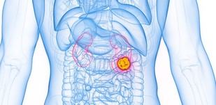 Nuevo protocolo nacional mejora el diagnóstico y tratamiento del cáncer de riñón en el Reino Unido
