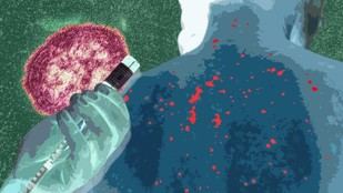 Aumentan casos de sarampión en México, expertos recomiendan vacunarse