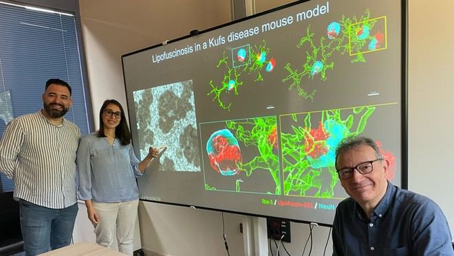 Desarrollan un modelo de ratón para estudiar una enfermedad neurodegenerativa centenaria