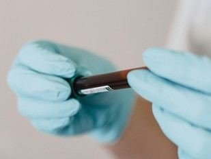 Identifican compuestos en sangre que predicen la diabetes tipo 2 años antes