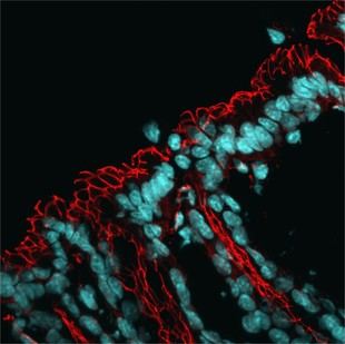 Identifican un mecanismo que afecta la microbiota intestinal y aumenta el riesgo de enfermedades