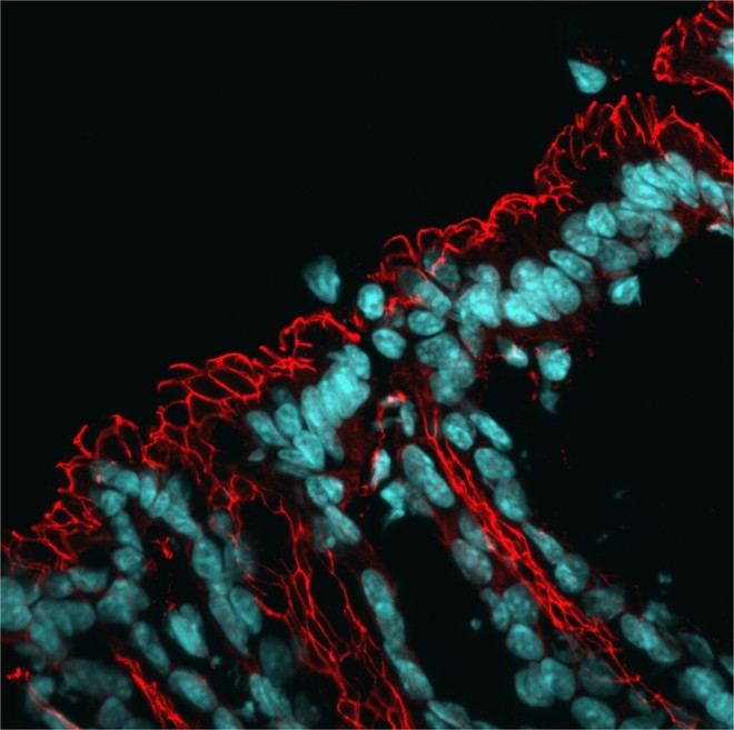 Identifican un mecanismo que afecta la microbiota intestinal y aumenta el riesgo de enfermedades