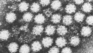 Genómica ayuda a identificar brotes de norovirus en un hospital español