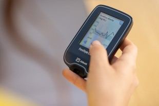 Identificación de subtipos de diabetes para mejorar el riesgo cardiovascular