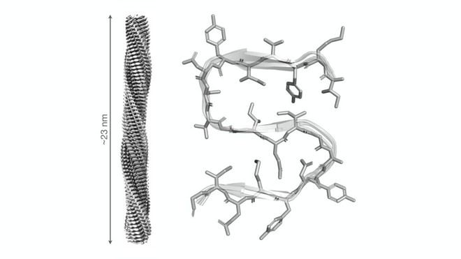 Descubren la estructura atómica de una proteína esencial en la muerte celular asociada a enfermedades neurodegenerativas