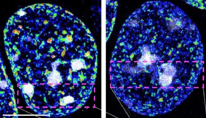Descubren cómo dos enzimas protegen la identidad de las neuronas