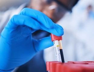 El Gobierno destina 30 millones a Universal DX para detección temprana de cáncer con IA