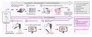 Proyecto europeo de IA transformará la cirugía del cáncer de mama en la UPM