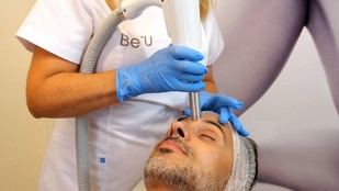 Científicos desarrollan tecnología indolora para rejuvenecer el rostro