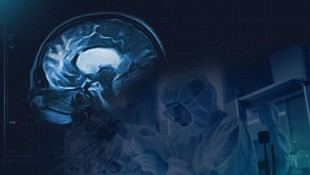 Resultados positivos en la fase 1 del fármaco SUL-238 para el Alzheimer