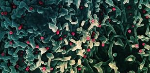 Detectan exposición oculta al virus mpox en adultos sanos de Nigeria