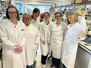 El legado de Sarah Harding transforma la vida de una mujer gracias a un estudio sobre el cáncer de mama