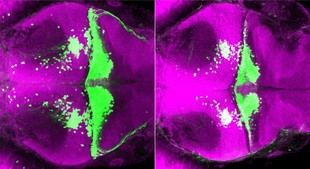 i3S revela función oculta del ADN vinculada a enfermedad neurodegenerativa rara
