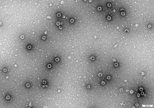 Descubren una enzima crucial en la infección por rotavirus y norovirus