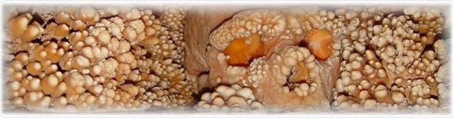 Descubren detalles inéditos sobre el nariz de los Neanderthales en un esqueleto hallado en Altamura