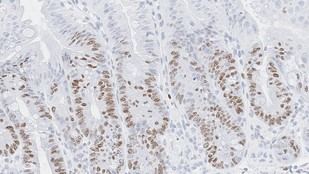 Descubren que células inmunitarias utilizan señales de inflamación para reparar el intestino tras tratamientos de cáncer