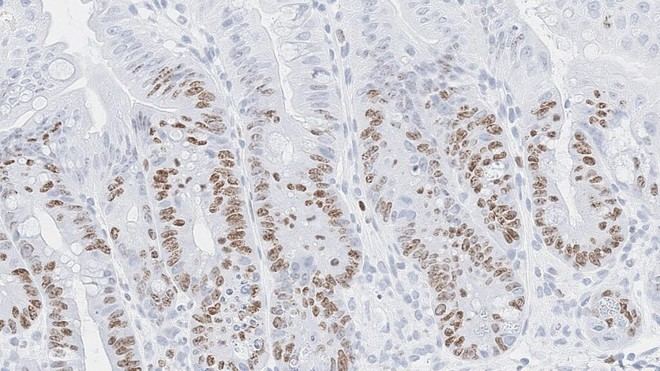 Descubren que células inmunitarias utilizan señales de inflamación para reparar el intestino tras tratamientos de cáncer