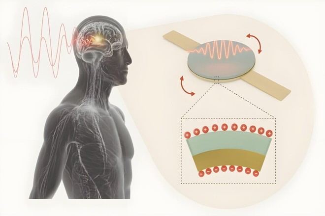 Antena inyectable para alimentar implantes médicos de forma segura
