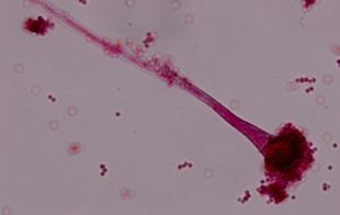 Propuesta global para combatir la resistencia a antifúngicos