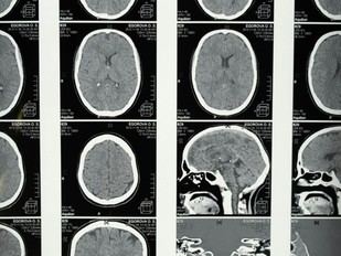 Jornadas de Invierno en Ciencias del Sistema Nervioso en la URV