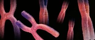 La Salle-URL lanza BeNeXT, un innovador proyecto para el diagnóstico temprano del Síndrome de Turner