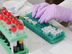 La UdG se une a tres redes doctorales sobre enzimas y gestión del agua potable