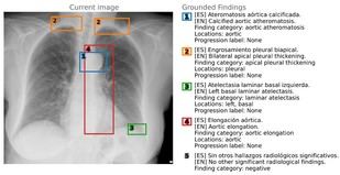 La Universidad de Alicante lanza un innovador conjunto de datos para radiología en IA médica