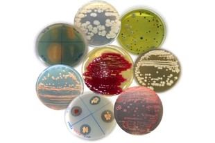 La Universidad de Pisa se une a la red MIRRI para proteger la biodiversidad microbiana