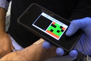 Desarrollan microagujas que generan QR codes para monitorear la química del cuerpo en tiempo real