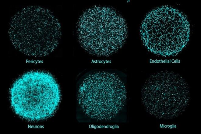 Investigadores del MIT crean un innovador modelo cerebral humano para la investigación de enfermedades y descubrimiento de fármacos