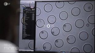 Nanorobots transforman células madre en células óseas