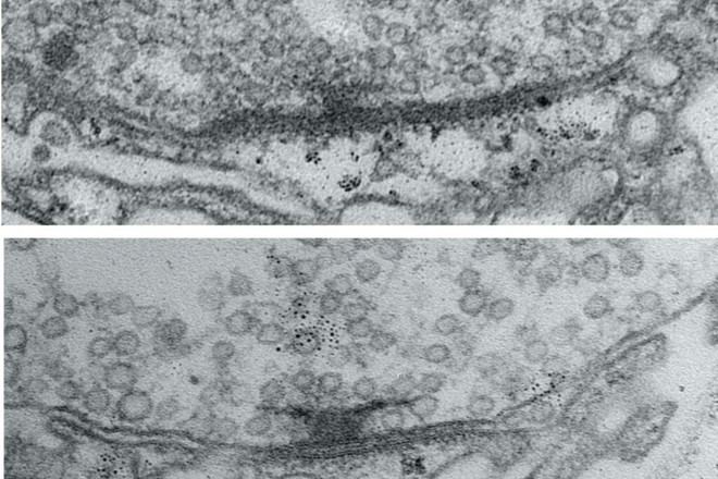 La actividad neural optimiza las conexiones sinápticas en el cerebro de las moscas