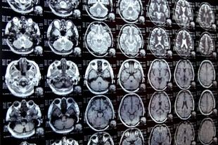 Nuevo sistema de IA promete acelerar la investigación clínica