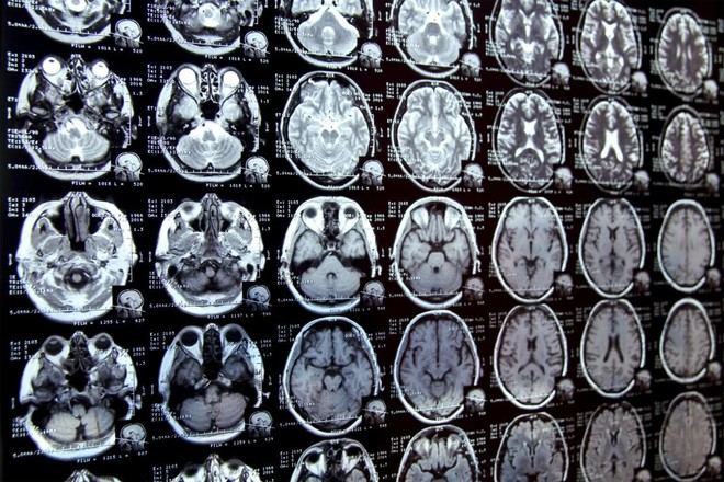 Nuevo sistema de IA promete acelerar la investigación clínica