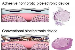 Nueva estrategia bioadhesiva previene la fibrosis en implantes de dispositivos en nervios periféricos