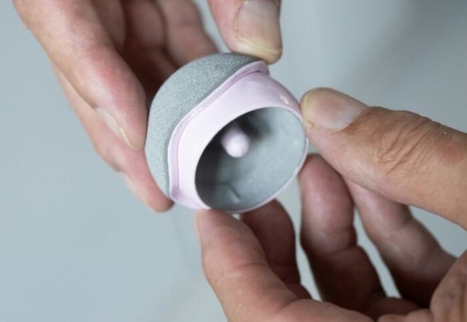 Implante innovador permite a mujeres acceder a cirugía de resurfacing de cadera con marca CE