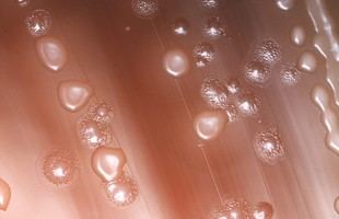 Nuevos hallazgos sobre antibióticos y neumococo en investigación del ISCIII