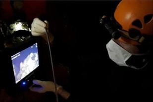 Nuevos hallazgos sobre la estructura nasal de los Neandertales a partir del esqueleto de Altamura