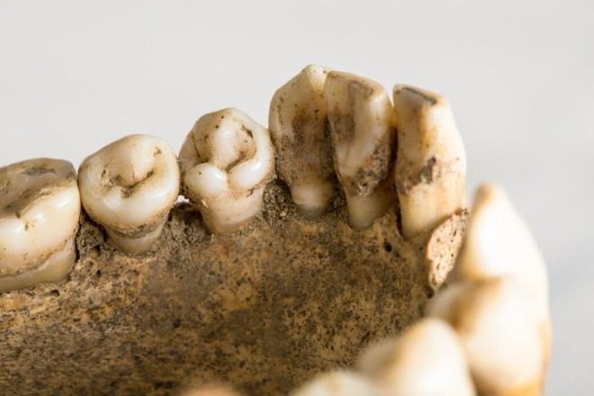 Investigación utiliza dientes prehistóricos para mapear enfermedades infecciosas históricas