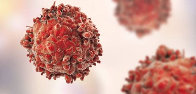 La presión altera el comportamiento de las células cancerosas