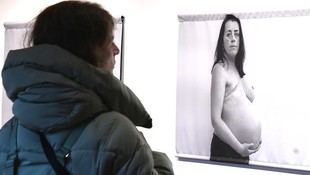 Exposición fotográfica visibiliza las experiencias de mujeres con cáncer