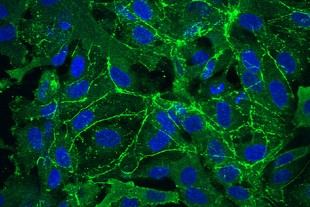 Investigadores del MIT hallan la genética detrás de vasos sanguíneos cerebrales permeables en el síndrome de Rett