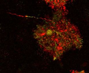 Descubren que astrocitos antes considerados sanos son patológicos en el cerebro