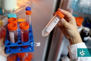 Investigación sobre síndrome metabólico revela efectos en huesos y arterias